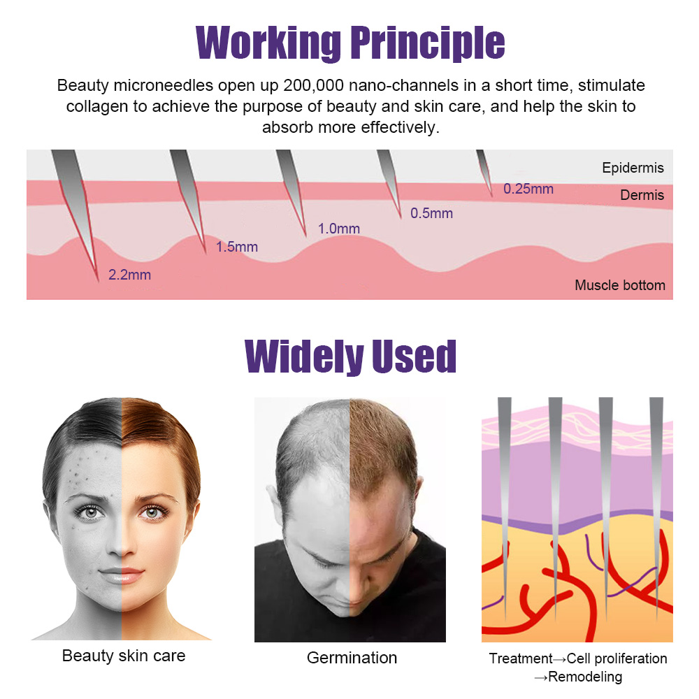 Natural Men Beard Growth Derma - đánh giá và giá Derma Roller 0.25